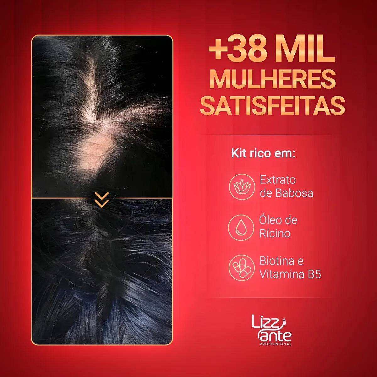 Sos Crescimento Rápido Combate Queda Calvície Falha Alopecia