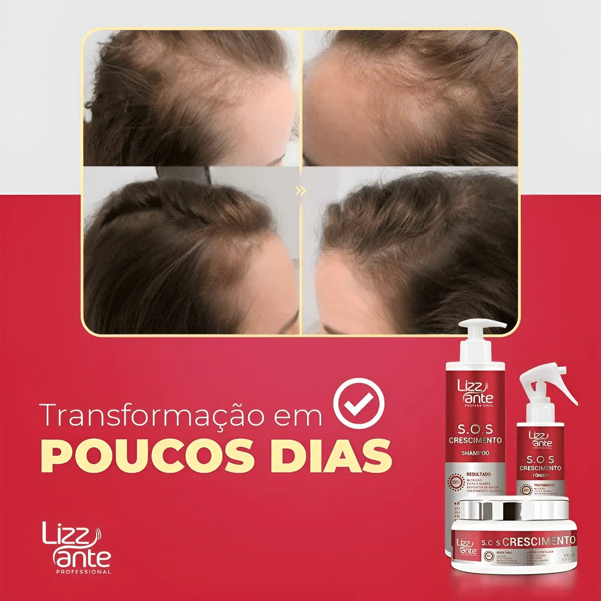 Sos Crescimento Rápido Combate Queda Calvície Falha Alopecia