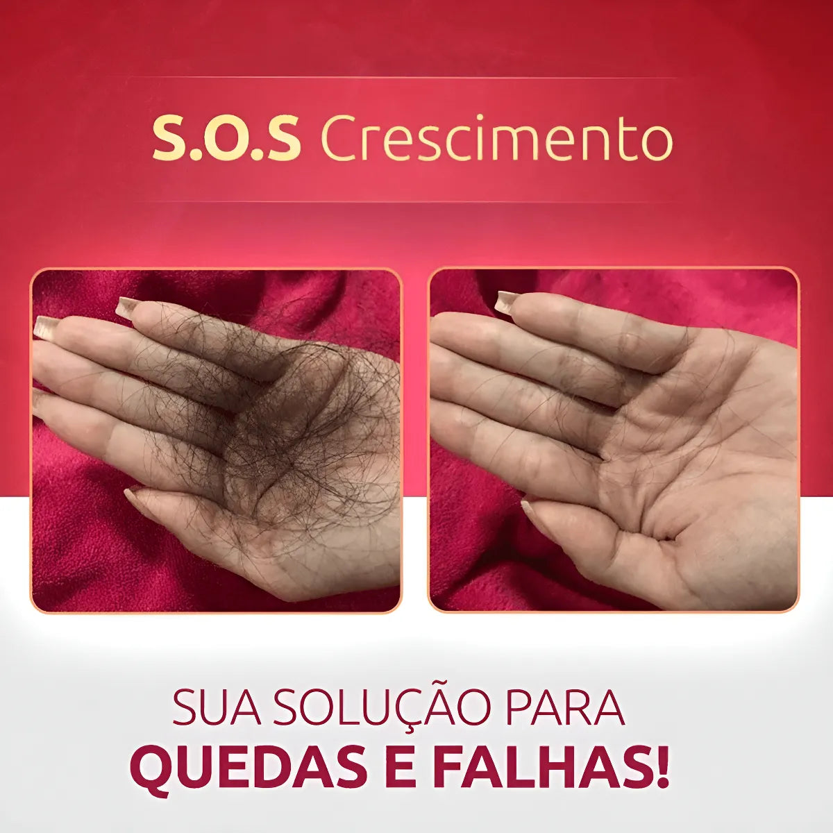 Sos Crescimento Rápido Combate Queda Calvície Falha Alopecia