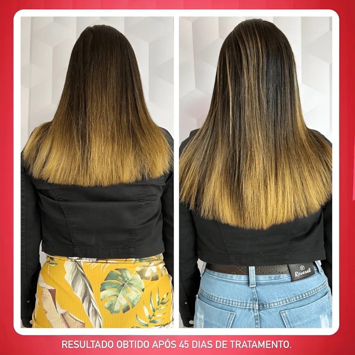 Sos Crescimento Rápido Combate Queda Calvície Falha Alopecia