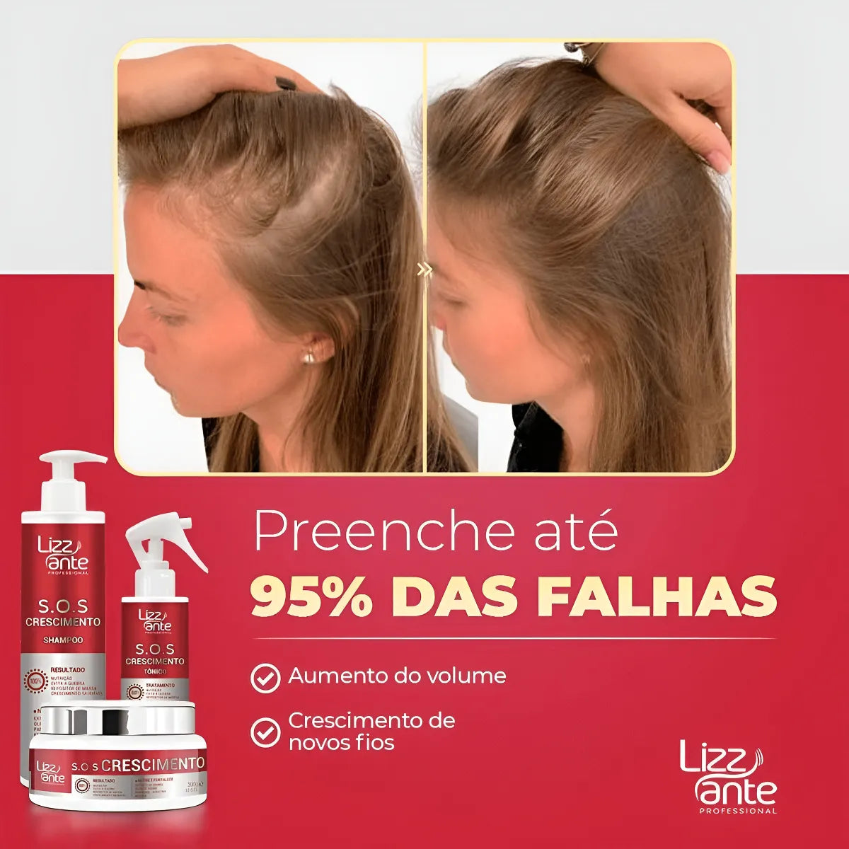 Sos Crescimento Rápido Combate Queda Calvície Falha Alopecia